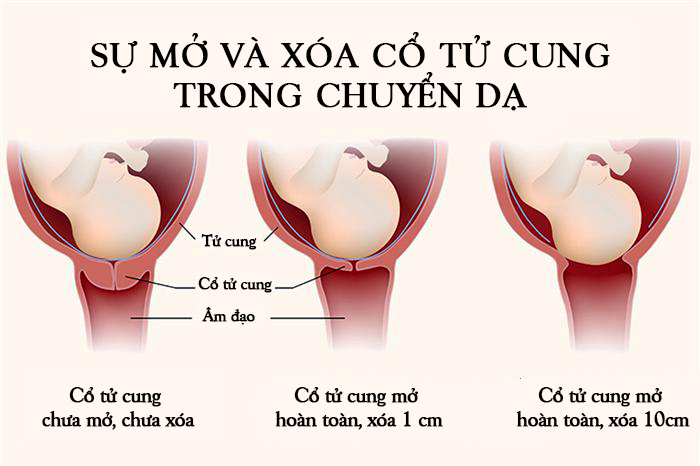 Việc cho bé bú sẽ giúp tử cung của bạn co thắt tốt, thúc đẩy nó mau chóng quay trở lại kích thước ban đầu