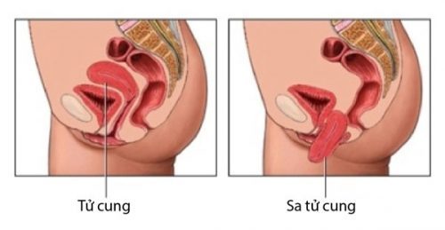  Nếu được phát hiện và chữa trị kịp thời, bạn có thể khỏi bệnh nhanh chóng.