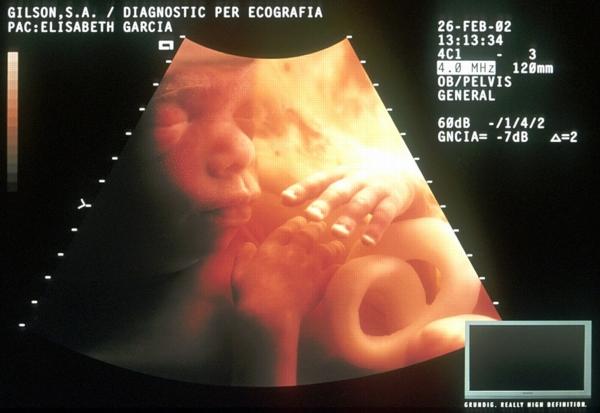 Siêu âm 4D có thể chụp được rất nhiều hình ảnh 3 chiều của thai nhi cùng một lúc