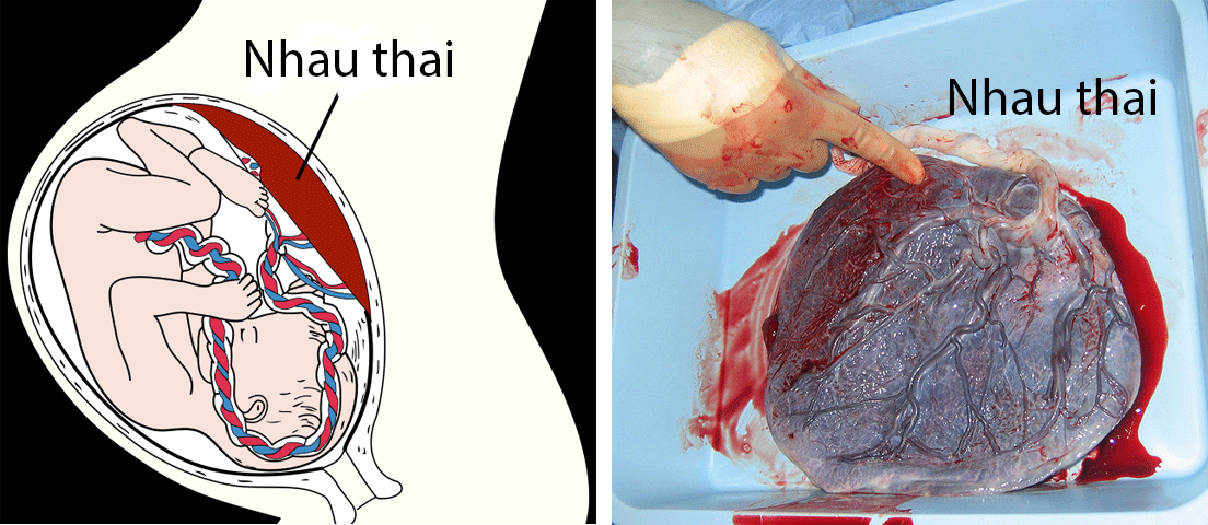 Thai nhi nhận oxy qua nhau thai và dây rốn