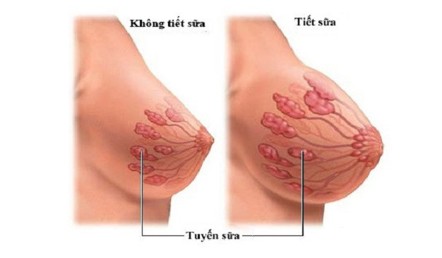 Dễ gây cảm giác đau khi đụng chạm.