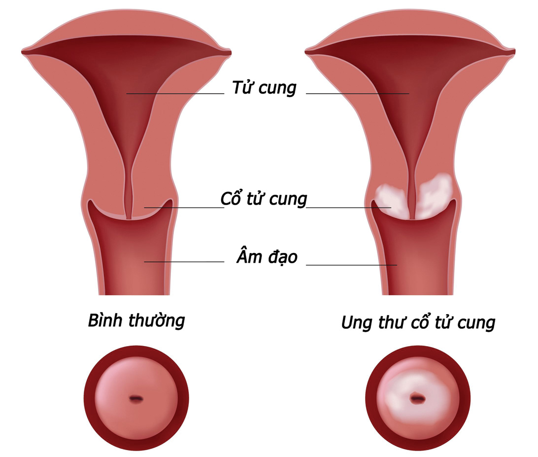 Sau 6 tuần, tử cung của bạn sẽ quay lại kích thước ban đầu.