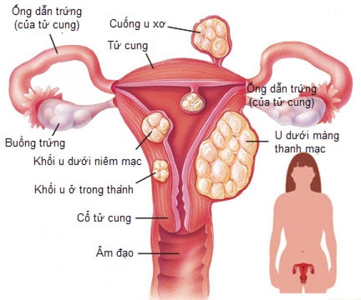 Tử cung sau sinh như thế nào là bình thường?