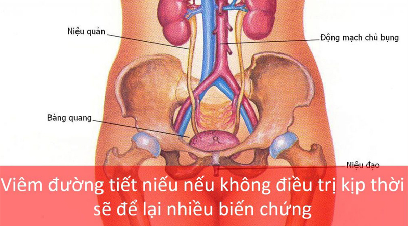 Bệnh viêm đường tiết niệu trong thai kỳ có thể gây biến chứng